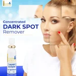 Miss White Brightening Serum 30ml | Advanced Dark Spot Corrector & Glow-Boosting Treatment | High-Performance Clarifying Serum for Flawless, Radiant Skin - Image 3