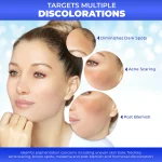 Miss White Brightening Serum 30ml | Advanced Dark Spot Corrector & Glow-Boosting Treatment | High-Performance Clarifying Serum for Flawless, Radiant Skin - Image 4
